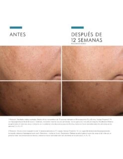 SKINCEUTICALS SERUM DISCOLORATION DEFENSE 30ML -Suavinex Ventas skinceuticals serum discoloration defense 30 ml 3